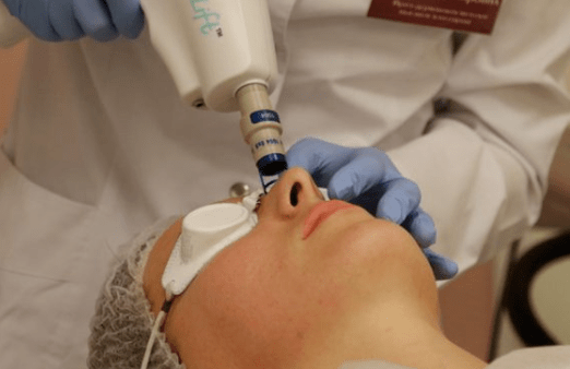 Niet -bare laserverjonging