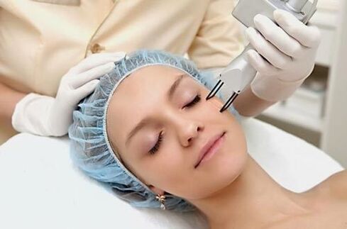 Veldlaser